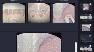 Keratinized stratified nonkeratinized stratified and transitional epithelium [upl. by Raimundo]