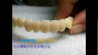 Sagemax美國全瓷瓷牙 sagemax NexxZr T Zirconia 氧化鋯瓷塊瓷牙 [upl. by Weintrob]