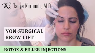 Nonsurgical Brow Lift [upl. by Myca379]