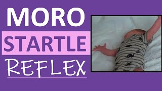 Moro Reflex Newborn Test  Startle Reflex  Pediatric Nursing Assessment [upl. by Valerie742]