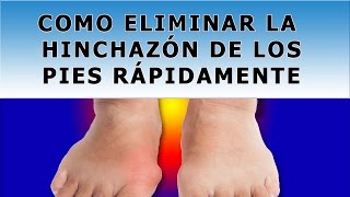 Metodos Naturales Para Quitar La Hinchazon De Los Pies [upl. by Enialedam695]