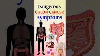 Cancer Symptoms You Should NEVER Ignore [upl. by Dira]