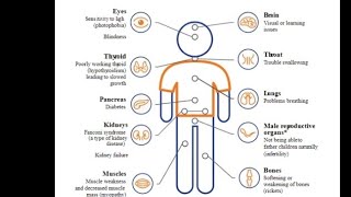 Mystery diagnosis Cystinosis [upl. by Akimad]