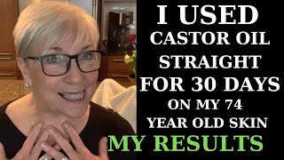 I USED CASTOR OIL FOR 30 DAYS ON MY 74YEAROLD SKIN  MY RESULTS [upl. by Welsh]