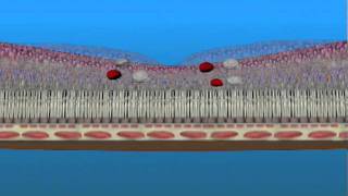 Macular Edema and Ischemia [upl. by Niuq298]