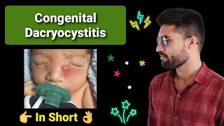 Congenital Dacryocystitis Lecture opthalmology [upl. by Liatris432]