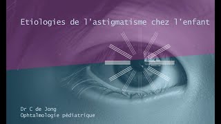 Etiologies de lastigmatisme chez lenfant [upl. by Ekud]