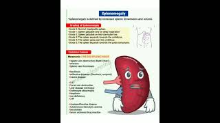 👒 Splenomegaly causes and grade 👒 [upl. by Aneba]