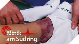 quotWir können ein anderes Bein dranmachenquot ScherzkeksArzt  Klinik am Südring  SAT1 TV [upl. by Stryker25]