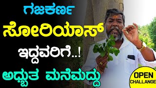 Psoriasis Ge Mane Maddu  Skin Disease In Kananda  Nati Vaidya  Dr Guide In Kannada [upl. by Akeber]