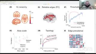 Neuroccino 13th May 2024  Statistical Power in Network Neuroscience [upl. by Ellehcin]