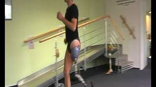 Above knee amputee running on prosthetic leg [upl. by Haraf]