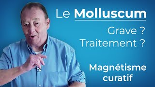 Le Molluscum Expliqué et Comment sen Débarrasser [upl. by Nodnab]