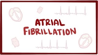 Atrial fibrillation Afib AF  causes symptoms treatment amp pathology [upl. by Oynotna]