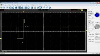 INYECTOR OSCILOGRAMA INTERPRETACION [upl. by Atila429]