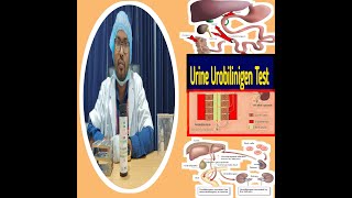 Urine Urobilinogen test in Bangla Urobilinogen in urine test Urobilinogen test procedure [upl. by Pantin905]