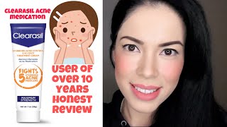 Clearasil Stubborn Acne Control 5 in 1 treatment Review [upl. by Anyah]