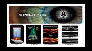 SPECTRALIS OCT  Approaching Optic Neuropathies [upl. by Romy]