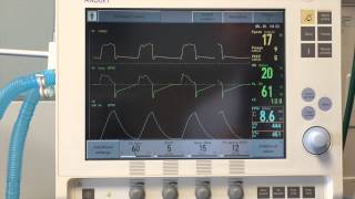 Introduction to Mechanical Ventilation [upl. by Eboh341]