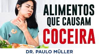 Alimentos Que Causam Coceira e Urticária  Dr Paulo Müller Dermatologista [upl. by Anelyak]