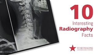 10 surprising radiology facts that you probably didn’t know [upl. by Alehtse]