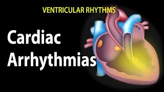 Cardiac Arrhythmias Animation [upl. by Hanavas428]