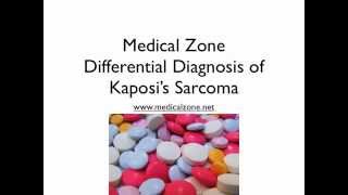 Medical Zone  Differential Diagnosis of Kaposis Sarcoma [upl. by Nabatse]