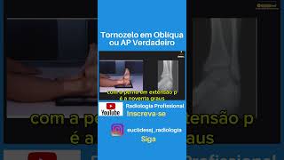 Tornozelo em Oblíqua ou AP Verdadeiro shorts tecnicosemradiologia tecnicosemradiologia [upl. by Egarton]