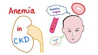 Anemia in Chronic Kidney Disease [upl. by Oratnek123]