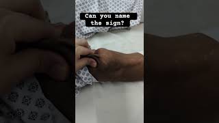 Can You name the sign Neetpg Usmle Neurology tips medicine doctor [upl. by Aicatan]