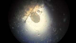 Scabies Mite Video HD [upl. by Spindell476]