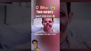 Face surgery 😰🥺new shorts youtubeshorts facesurgery zombieshorts [upl. by Niwrehs]