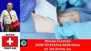 Learn How to Staple Wound Closure Series by Dr Alton [upl. by Jard]