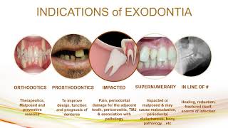 indication and contraindication of exodontia [upl. by Melleta326]