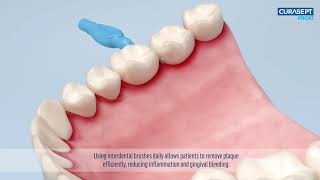 Jak używać szczoteczek międzyzębowych Curasept [upl. by Dopp896]