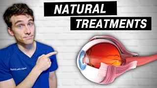 7 Natural Ways to Prevent amp Treat Glaucoma  QampA [upl. by Hama]