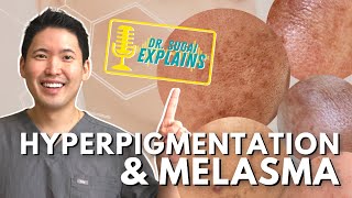 Dermatologist Explains Hyperpigmentation and Melasma  How to Manage it with Top Picks [upl. by Norry639]