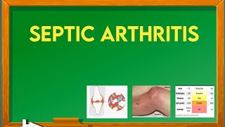 septic arthritis risk factors causes  sign and symptoms diagnosis and treatment ImMEDICAL [upl. by Brocklin351]