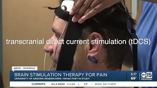 Brain stimulation therapy for pain [upl. by Gabbey]