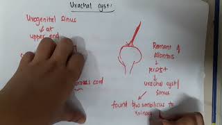 7 2 urachal cyst mp4  Anatomy [upl. by Rivy]