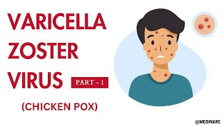 Varicella Zoster virus  Part 1  Made very easy  Medinare [upl. by Pomona668]