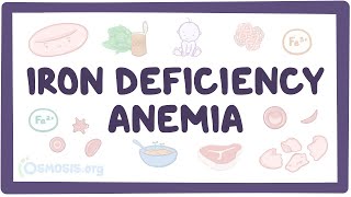 Iron deficiency anemia  an Osmosis Preview [upl. by Laveen]