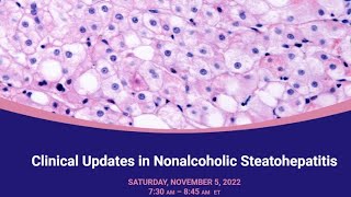 Clinical Updates in Nonalcoholic Steatohepatitis [upl. by Jarin]