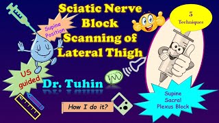 Ultrasound Scanning Principles for Supine Lateral Sacral Plexus or Sciatic Nerve Block DrTuhinM [upl. by Aikemahs]