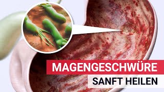 Magengeschwüre sanft heilen [upl. by Gan]