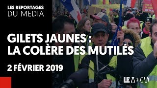 GILETS JAUNES  LA COLÈRE DES MUTILÉS [upl. by Hillyer]