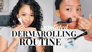 REMOVE ACNE SCARS COMPLETELY UPDATED MICRONEEDLING AT HOME ROUTINE  Pamela Ross [upl. by Denoting]