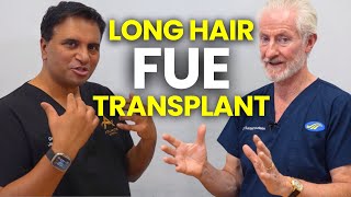 Long Hair FUE for Hair Transplant Surgery [upl. by Nam689]