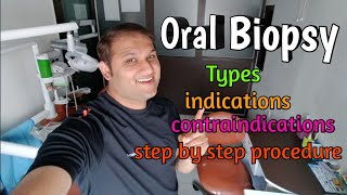 Oral Biopsy Types Purpose indications contraindications and step by step Procedure [upl. by Airelav660]