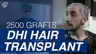 2500 Grafts DHI Hair Transplant Surgery MUST SEE [upl. by Ardnuhs]